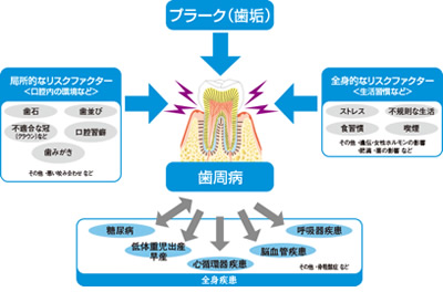 歯周病　間接的な原因