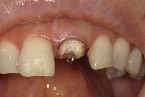 Before
