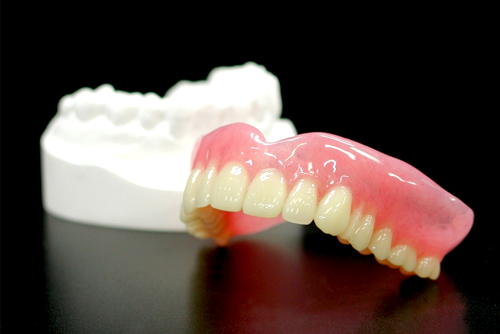 implant Q&A